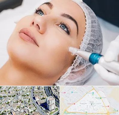 مزونیدلینگ در قاسم آباد مشهد