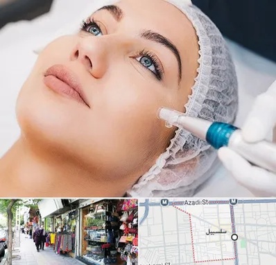 مزونیدلینگ در سلسبیل