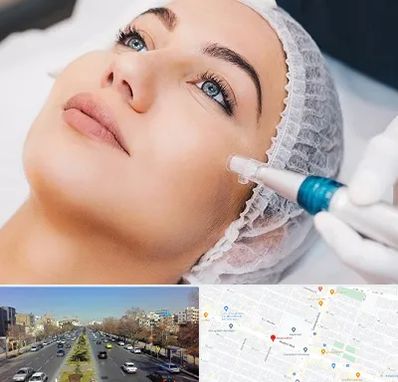 مزونیدلینگ در بلوار معلم مشهد