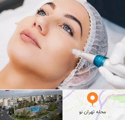 مزونیدلینگ در تهران نو