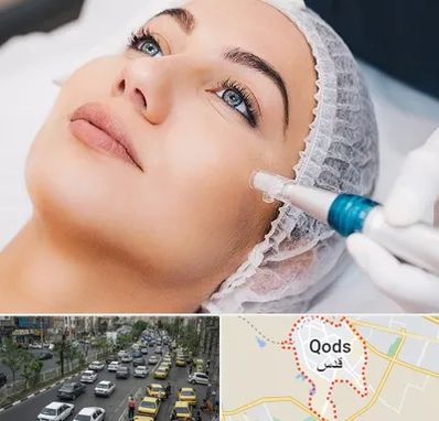 مزونیدلینگ در شهر قدس