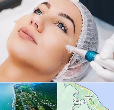 مزونیدلینگ در رامسر