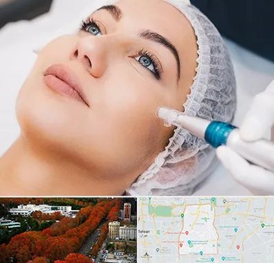 مزونیدلینگ در منطقه 6 تهران 