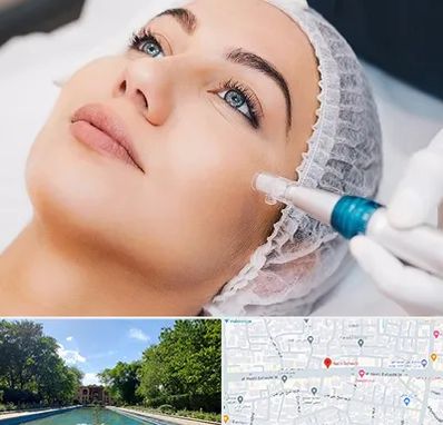 مزونیدلینگ در هشت بهشت اصفهان