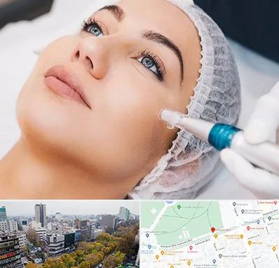 مزونیدلینگ در بلوار کشاورز 