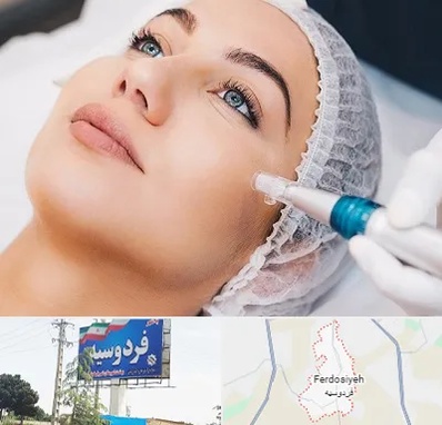 مزونیدلینگ در فردوسیه شهریار