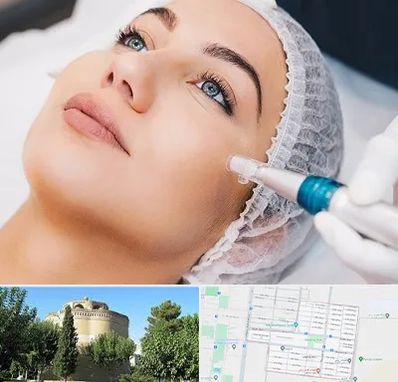 مزونیدلینگ در مرداویج اصفهان