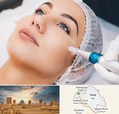 مزونیدلینگ در یزد