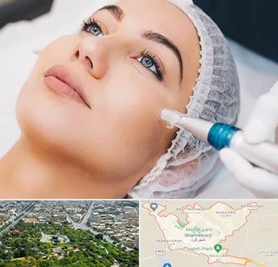 مزونیدلینگ در شهرکرد