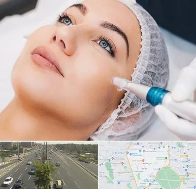 مزونیدلینگ در منطقه 17 تهران 