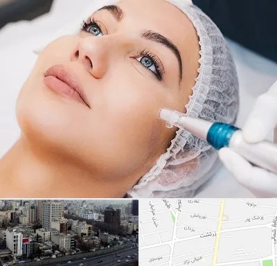 مزونیدلینگ در زرتشت