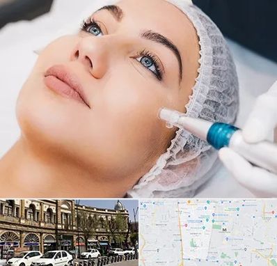 مزونیدلینگ در منطقه 11 تهران 