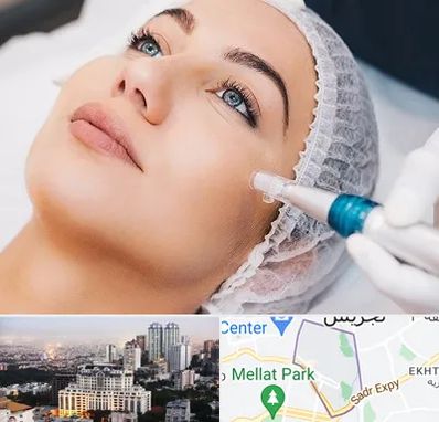 مزونیدلینگ در الهیه 