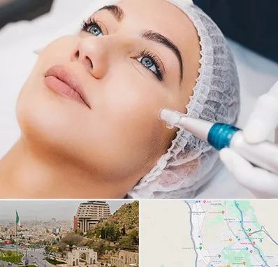 مزونیدلینگ در فرهنگ شهر شیراز