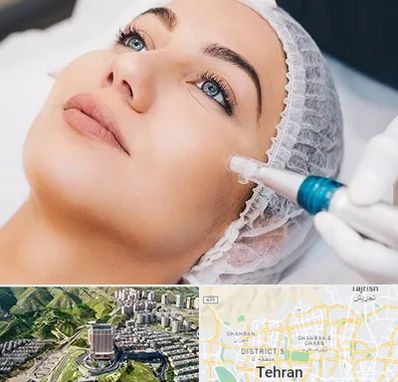 مزونیدلینگ در شمال تهران 