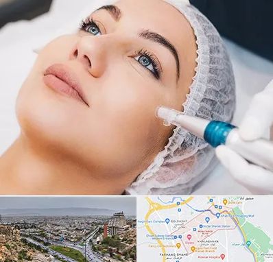 مزونیدلینگ در معالی آباد شیراز