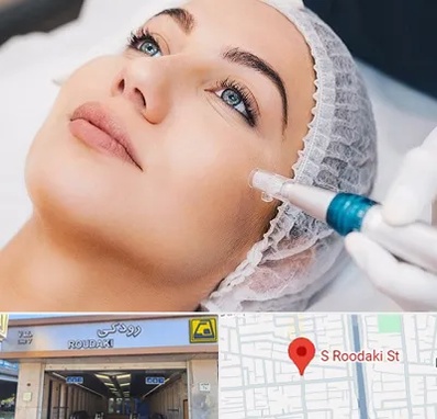 مزونیدلینگ در رودکی
