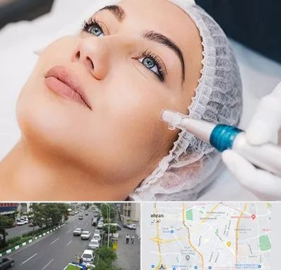 مزونیدلینگ در ستارخان 