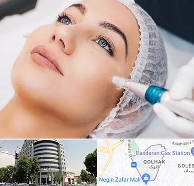 مزونیدلینگ در قلهک 