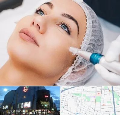 مزونیدلینگ در بلوار اباذر