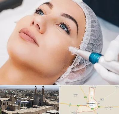 مزونیدلینگ در سبزوار