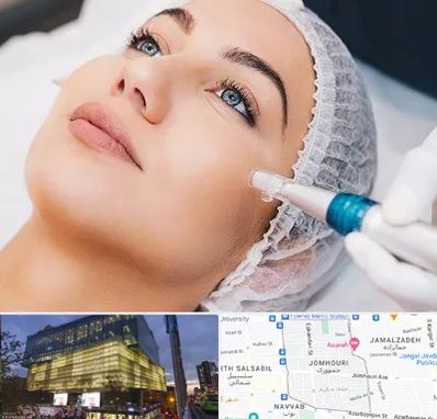 مزونیدلینگ در جمهوری 