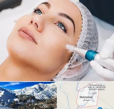 مزونیدلینگ در شمشک