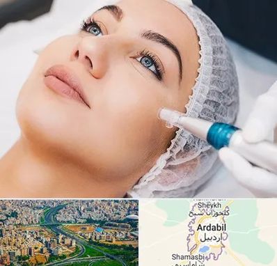 مزونیدلینگ در اردبیل