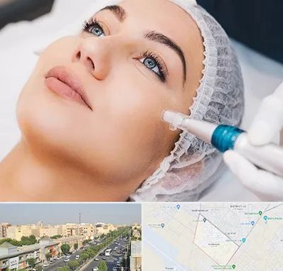 مزونیدلینگ در کیانمهر کرج