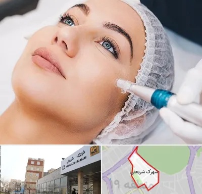 مزونیدلینگ در شهرک شریعتی