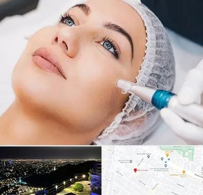 مزونیدلینگ در هفت تیر مشهد