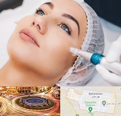 مزونیدلینگ در بهارستان