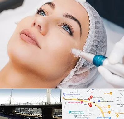 مزونیدلینگ در پارک وی 