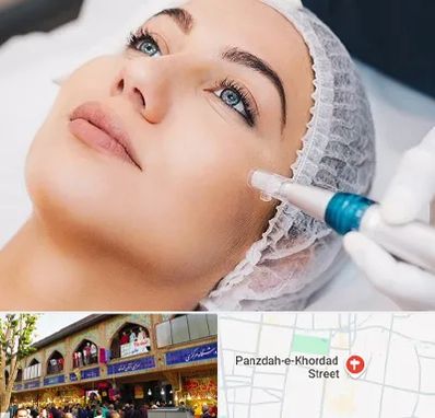 مزونیدلینگ در 15 خرداد