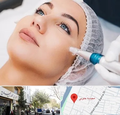 مزونیدلینگ در مجیدیه جنوبی