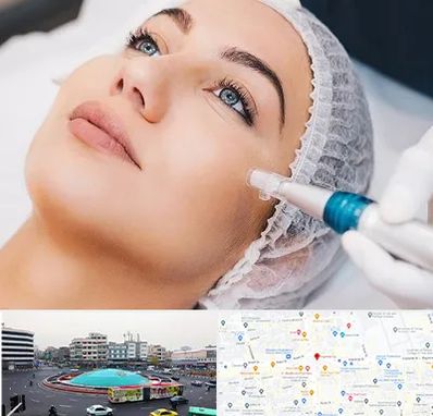 مزونیدلینگ در میدان انقلاب 