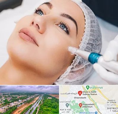 مزونیدلینگ در قصرالدشت شیراز