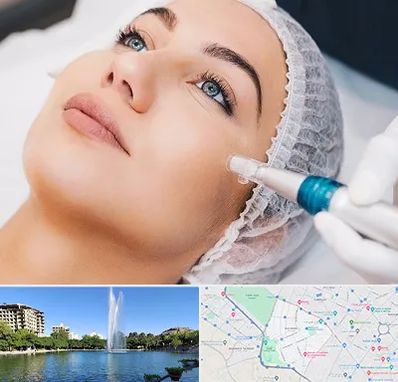 مزونیدلینگ در کوهسنگی مشهد