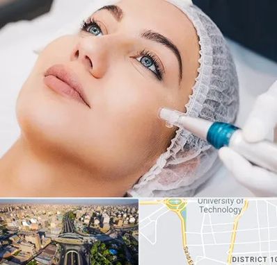 مزونیدلینگ در استاد معین 