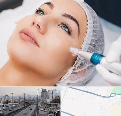 مزونیدلینگ در بلوار ارتش