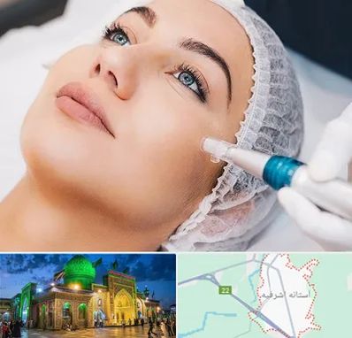 مزونیدلینگ در آستانه اشرفیه