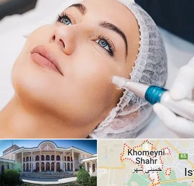 مزونیدلینگ در خمینی شهر