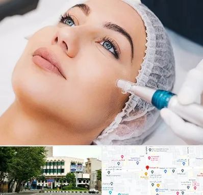 مزونیدلینگ در طالقانی 