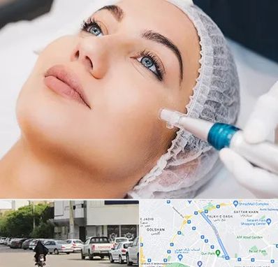 مزونیدلینگ در قدوسی شرقی شیراز