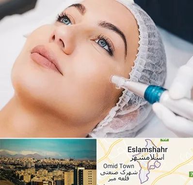 مزونیدلینگ در اسلامشهر