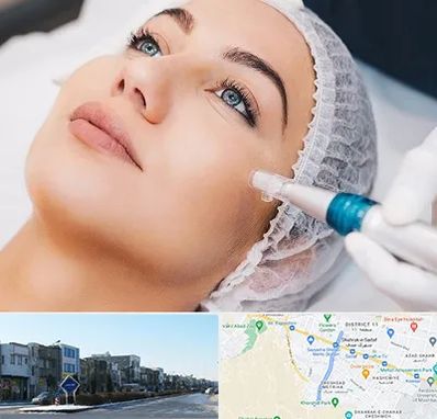 مزونیدلینگ در شریعتی مشهد