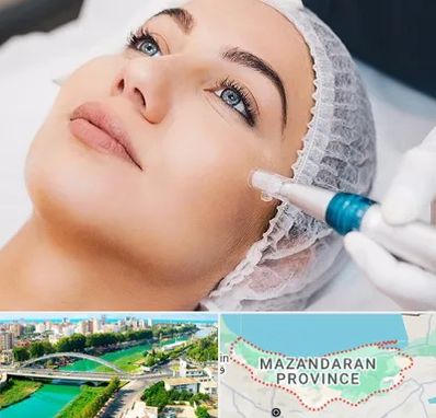 مزونیدلینگ در مازندران