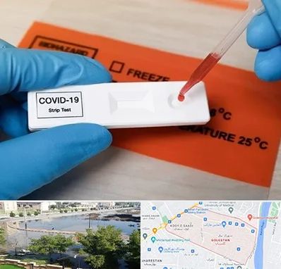 آزمایشگاه کرونا در گلستان اهواز