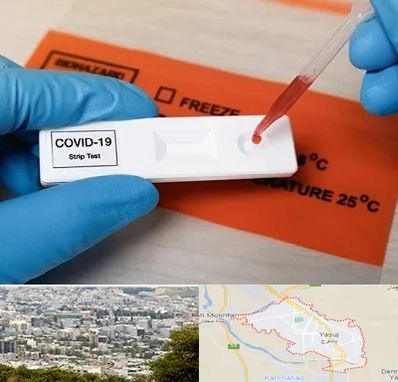 آزمایشگاه کرونا در یاسوج