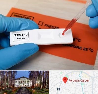 آزمایشگاه کرونا در باغ فردوس